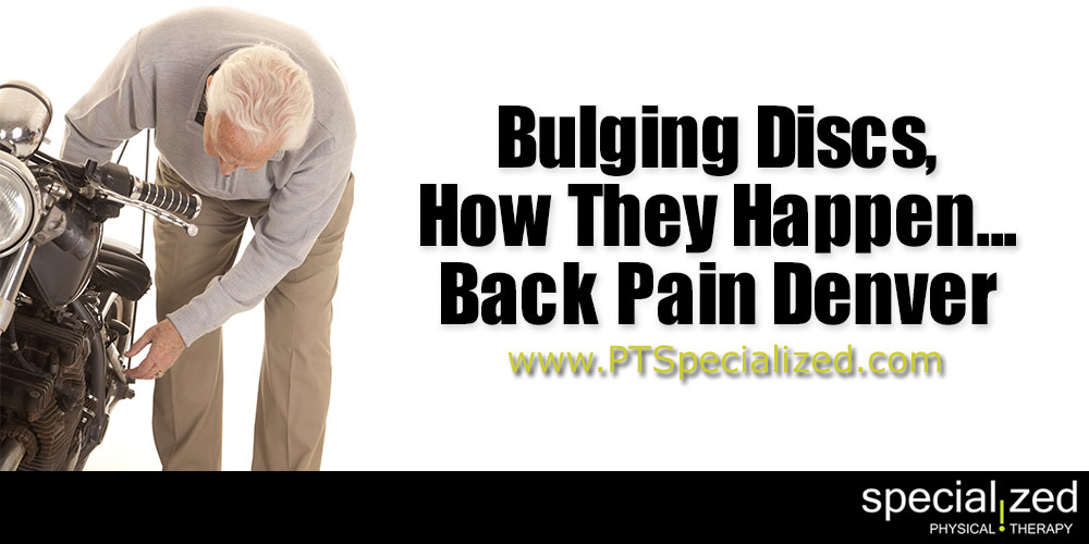 Bulging Discs - How They Happen | Back Pain Denver